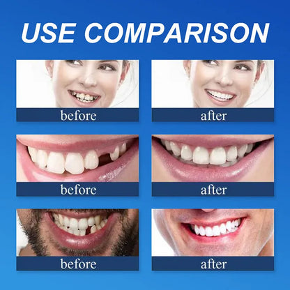🔥Ends Today: 79% OFF! ⏰DarkFairy™ Medical Full Denture with Strong Suctiond Custom-Fit Full Functional Dentures🦷