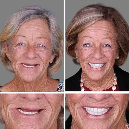 🔥Ends Today: 79% OFF! ⏰DarkFairy™ Medical Full Denture with Strong Suctiond Custom-Fit Full Functional Dentures🦷