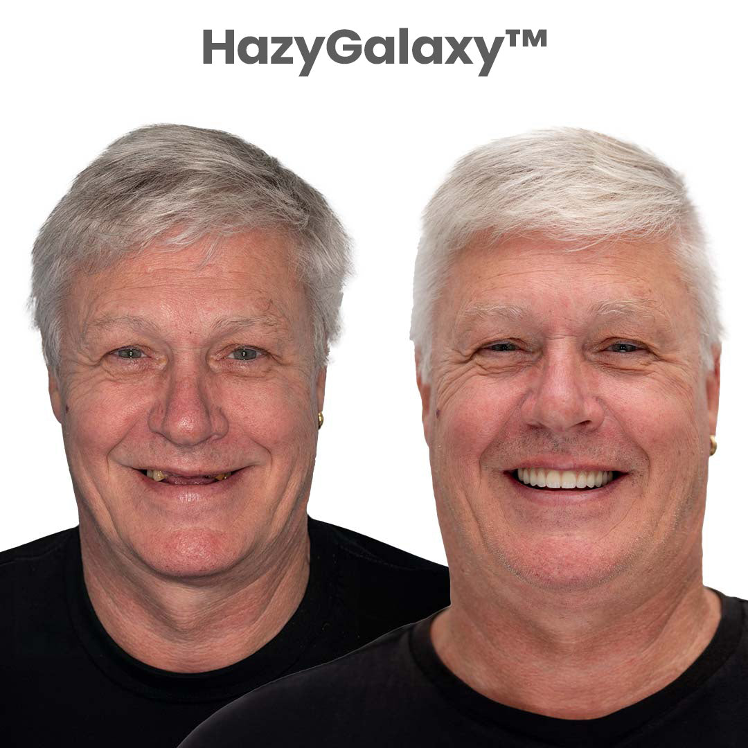 ✨ Instantly Restore Your Smile — HazyGalaxy™ Dentures 70% OFF Today Only 🦷